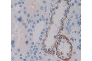 IHC-P analysis of Human Tissue, with DAB staining. (PLXNB1 anticorps  (AA 47-173))