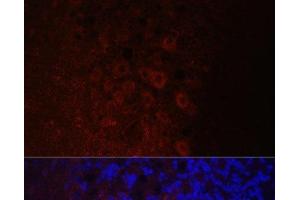 Immunofluorescence analysis of Rat brain using NEFH Polyclonal Antibody at dilution of 1:100. (NEFH anticorps)