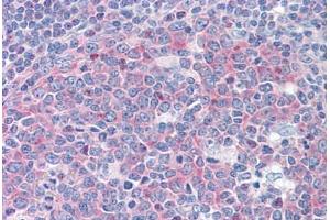 Human Tonsil: Formalin-Fixed, Paraffin-Embedded (FFPE) (FARSB anticorps  (AA 234-342))