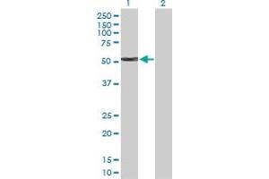 Western Blot analysis of KRT4 expression in transfected 293T cell line by KRT4 MaxPab polyclonal antibody. (KRT4 anticorps  (AA 1-534))