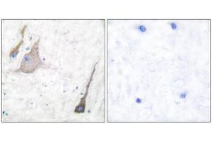 Immunohistochemistry (IHC) image for anti-Synuclein (SYU) (N-Term), (pan) antibody (ABIN1848790)