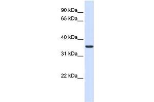 WB Suggested Anti-TXNDC14 Antibody Titration:  0. (TMX2 anticorps  (Middle Region))