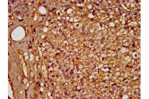 IHC image of ABIN7155179 diluted at 1:600 and staining in paraffin-embedded human adrenal gland tissue performed on a Leica BondTM system. (PDE9A anticorps  (AA 426-533))