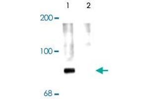 Western blot of rat cortex lysate showing specific labeling of the ~78k Syn1 protein phosphorylated at Ser 62,67 (Control).