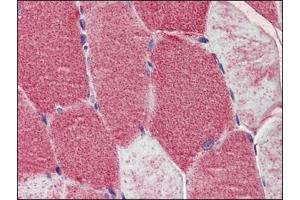 Human Skeletal Muscle: Formalin-Fixed, Paraffin-Embedded (FFPE) (POLG anticorps  (AA 829-1201))
