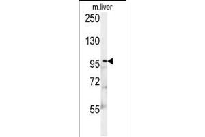 Western blot analysis in mouse liver tissue lysates (15ug/lane). (KIF9 anticorps  (C-Term))