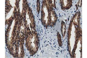 Image no. 9 for anti-Acetyl-CoA Acetyltransferase 2 (ACAT2) antibody (ABIN1496396)