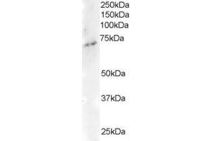 Western Blotting (WB) image for anti-Engulfment and Cell Motility 3 (ELMO3) (C-Term) antibody (ABIN2465648) (ELMO3 anticorps  (C-Term))