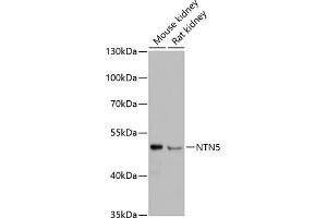 Western blot analysis of extracts of various cell lines, using NTN5 antibody (ABIN6132148, ABIN6144903, ABIN6144904 and ABIN6217109) at 1:3000 dilution. (Netrin 5 anticorps  (AA 340-489))