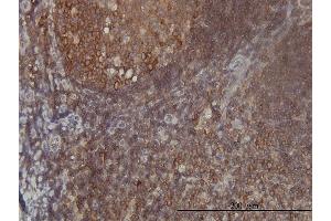 Immunoperoxidase of monoclonal antibody to FARSLB on formalin-fixed paraffin-embedded human tonsil tissue.