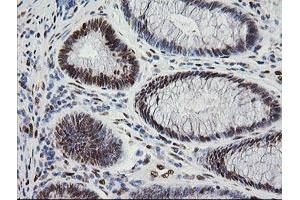 Image no. 6 for anti-Zinc Finger and SCAN Domain Containing 18 (ZSCAN18) antibody (ABIN1501858) (ZSCAN18 anticorps)