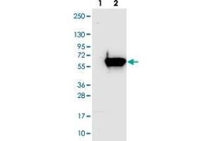 Western blot analysis of Lane 1: Negative control (vector only transfected HEK293T lysate). (AGXT2L1 anticorps)