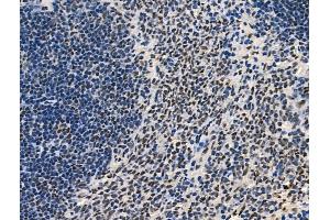 Phospho-SirT1 (Thr530) Antibody at 1/100 staining Rat spleen tissue by IHC-P. (SIRT1 anticorps  (pThr530))