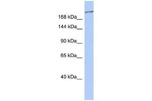 CACNA1G antibody used at 1 ug/ml to detect target protein. (CACNA1G anticorps  (Middle Region))