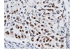 Image no. 2 for anti-5'-Nucleotidase Domain Containing 1 (NT5DC1) antibody (ABIN1499837)