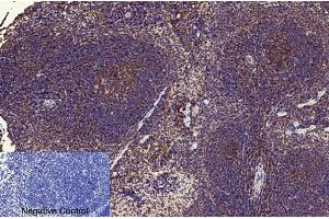 Immunohistochemical analysis of paraffin-embedded mouse spleen tissue. (NF-kB p65 anticorps  (acLys310))