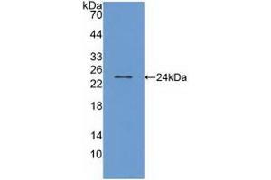 Detection of Recombinant TRPV1, Human using Polyclonal Antibody to Transient Receptor Potential Cation Channel Subfamily V, Member 1 (TRPV1)
