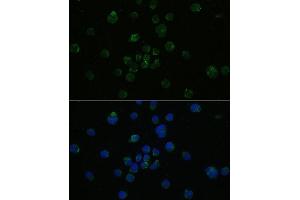 Immunofluorescence analysis of Jurkat cells using CD4 antibody (ABIN6132069, ABIN6138186, ABIN6138188 and ABIN6213820) at dilution of 1:100. (CD4 anticorps  (AA 26-200))