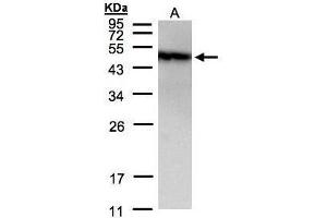 WB Image Sample(30 μg of whole cell lysate) A:A431, 12% SDS PAGE antibody diluted at 1:1500