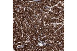 Immunohistochemical staining of human liver with ATHL1 polyclonal antibody  shows strong cytoplasmic positivity in hepatocytes at 1:20-1:50 dilution. (ATHL1 anticorps)