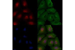 ABIN6259212 and ABIN6273405 staining  cells by IF/ICC.
