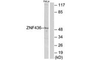 Western blot analysis of extracts from HeLa cells, using ZNF436 Antibody. (ZNF436 anticorps  (AA 71-120))