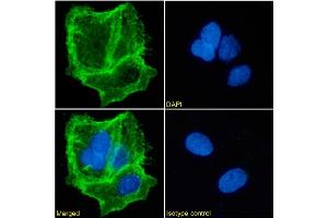Immunofluorescence staining of Caco-2 cells using anti-EpCAM.