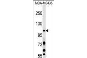 Western blot analysis in MDA-MB435 cell line lysates (35ug/lane). (PIK3CB anticorps  (N-Term))