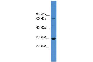 anti-High Mobility Group Box 1 (HMGB1) (N-Term) antibody