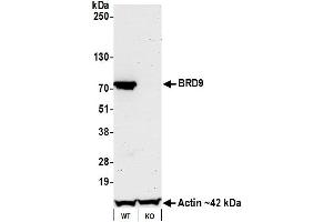 Western Blotting (WB) image for anti-Bromodomain Containing 9 (BRD9) (AA 547-597) antibody (ABIN7455162) (Recombinant BRD9 anticorps  (AA 547-597))