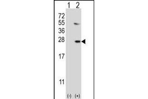 Western blot analysis of UBE2G1 (arrow) using rabbit polyclonal UBE2G1 Antibody (R11) (ABIN388859 and ABIN2839161).