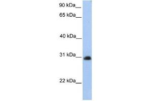 CHST14 antibody used at 1 ug/ml to detect target protein. (CHST14 anticorps)