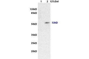 L1 rat brain lysates L2 rat intestine lysates probed with Anti Desmin/DES Polyclonal Antibody, Unconjugated (ABIN736566) at 1:200 overnight at 4 °C.