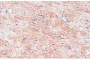 Immunohistochemistry of paraffin-embedded Rat heart using RPIA Polyclonal Antibody at dilution of 1:100 (40x lens). (Ribose 5-Phosphate Isomerase A (RPIA) anticorps)