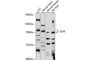 Western blot analysis of extracts of various cell lines, using GHR antibody (ABIN7267519) at 1:1000 dilution. (Growth Hormone Receptor anticorps  (AA 26-260))