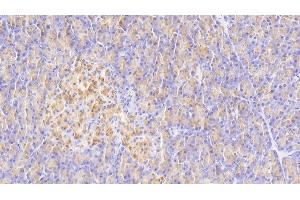 Detection of ELA3A in Human Pancreas Tissue using Polyclonal Antibody to Elastase 3A (ELA3A) (Elastase 3A anticorps  (AA 16-270))