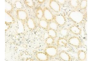 ABIN6263465 and ABIN6279559 at 1/100 staining human normal kidney tissue by IHC-P. (MYH3 anticorps  (C-Term))