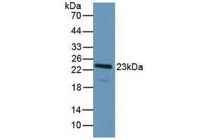 Western blot analysis of Human HeLa cells. (PDCD6 anticorps  (AA 32-191))