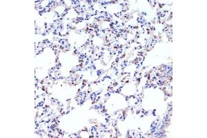 Immunohistochemistry of paraffin-embedded rat lung using SFTPC antibody (ABIN3015597, ABIN3015598, ABIN3015599, ABIN1682683 and ABIN6218961) at dilution of 1:200 (40x lens).