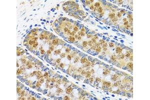 Immunohistochemistry of paraffin-embedded Human colon using GOT1 Polyclonal Antibody at dilution of 1:100 (40x lens).