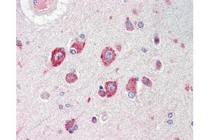 Anti-CACNG8 antibody IHC staining of human brain, cortex. (CACNG8 anticorps  (AA 90-119))