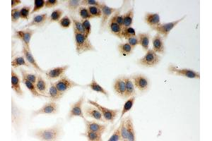 IHC analysis of CLOCK using anti-CLOCK antibody .