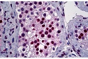 Human, Testis: Formalin-Fixed Paraffin-Embedded (FFPE) (YY1 anticorps  (AA 221-321))