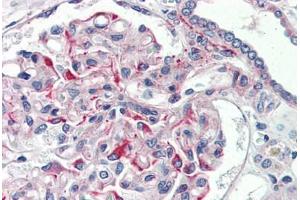 Human Kidney (formalin-fixed, paraffin-embedded) stained with JAG1 antibody ABIN337168 at 5 ug/ml followed by biotinylated goat anti-rabbit IgG secondary antibody ABIN481713, alkaline phosphatase-streptavidin and chromogen. (JAG1 anticorps  (AA 110-125))