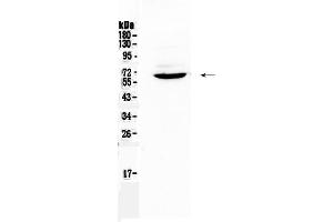 Western blot analysis of Heparanase 1 using anti-Heparanase 1 antibody . (HPSE anticorps  (AA 206-457))