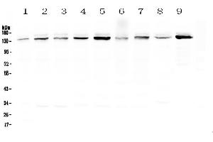 Western blot analysis of HAUSP/USP7 using anti-HAUSP/USP7 antibody . (USP7 anticorps  (AA 258-483))