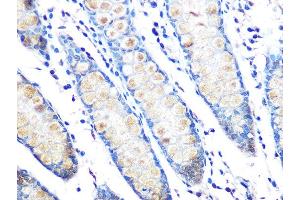 Immunohistochemistry of paraffin-embedded human colon using MUC2 Rabbit mAb (ABIN7268689) at dilution of 1:100 (40x lens). (MUC2 anticorps)