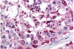 Human Testis (formalin-fixed, paraffin-embedded) stained with APOBEC3G antibody ABIN214726 at 5 ug/ml followed by biotinylated goat anti-rabbit IgG secondary antibody ABIN481713, alkaline phosphatase-streptavidin and chromogen.