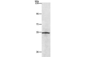 Western Blot analysis of Lovo cell using NEK2 Polyclonal Antibody at dilution of 1:727 (NEK2 anticorps)