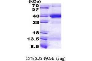 SDS-PAGE (SDS) image for Major Histocompatibility Complex Class I C (HLA-C) (AA 25-308) protein (His tag) (ABIN5853105)